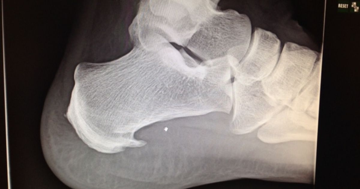 an X-ray of my foot